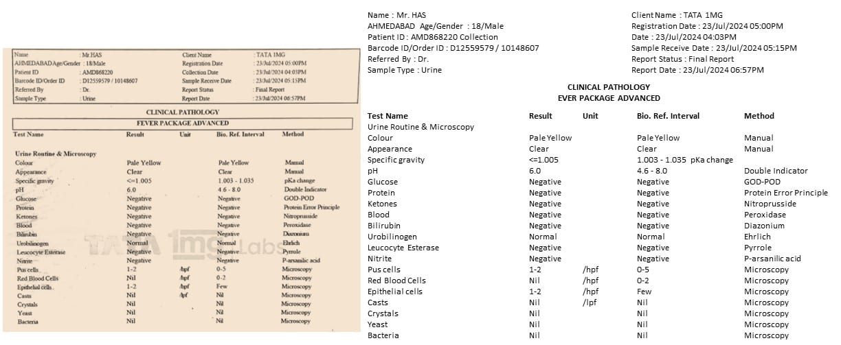 Table ocr