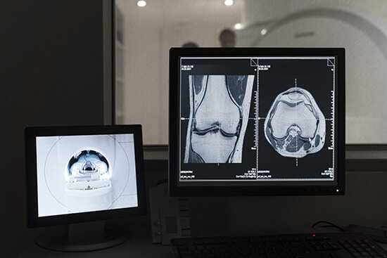 Ct scan image dataset