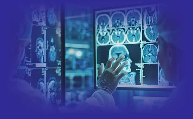 Mri de‑identification research