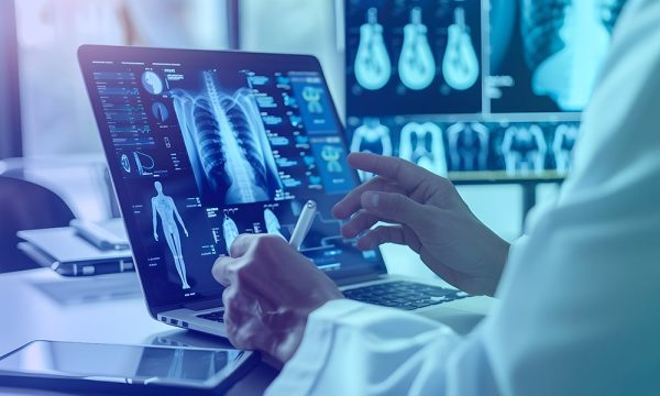 NLP in Radiology